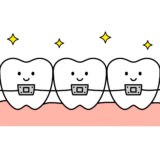 歯列矯正後の悩み